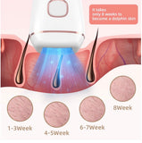 Pristine Hair Removal Device